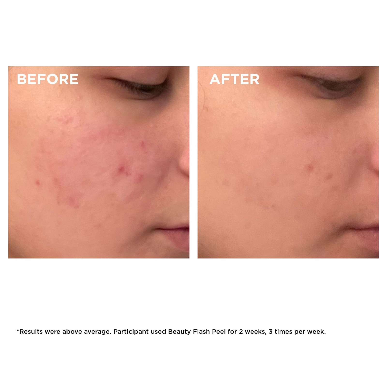 Clarins Beauty Flash Peel | 10-Minute At-Home Facial | Visibly Tightens Pores…