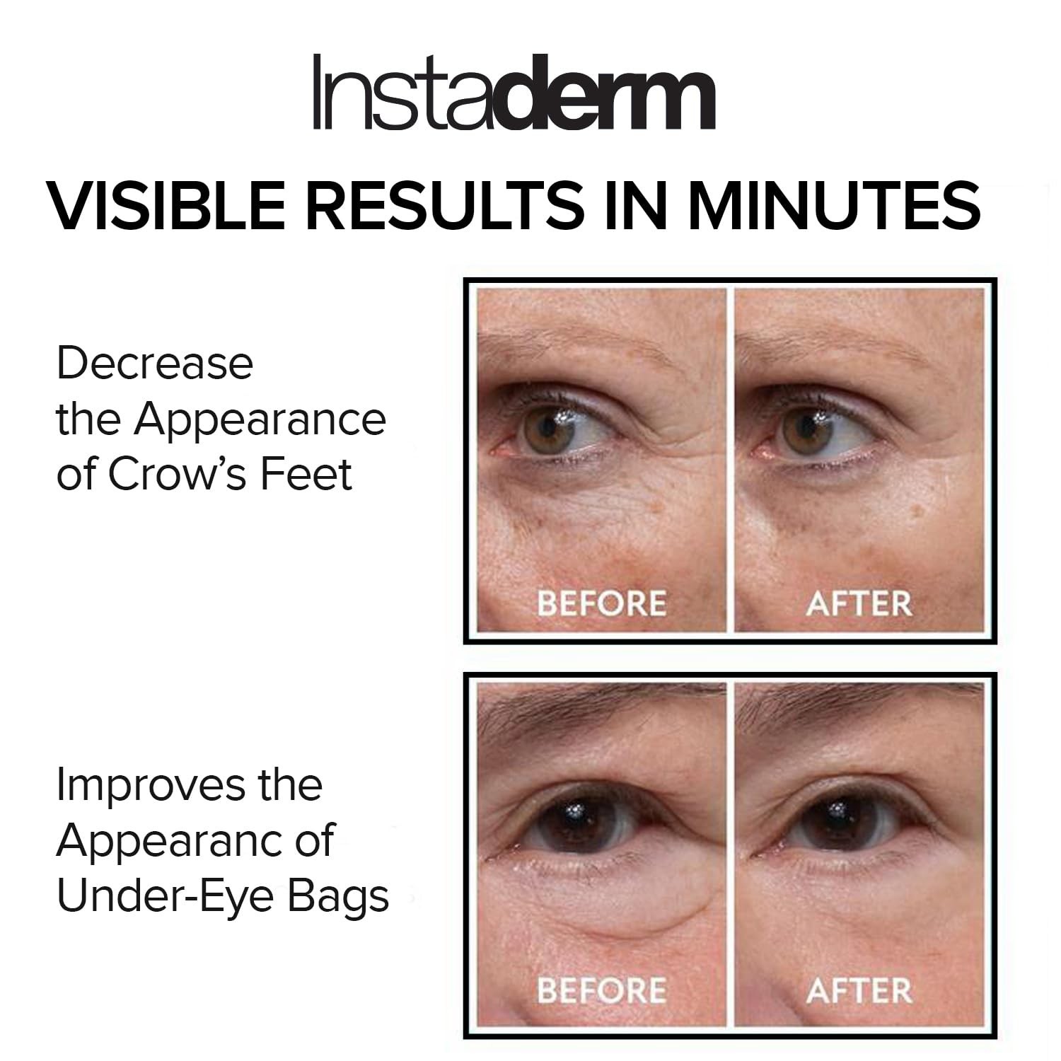 Instant Eye Tightener – Instantly Reduces Under Eye Bags, Puffiness, Dark