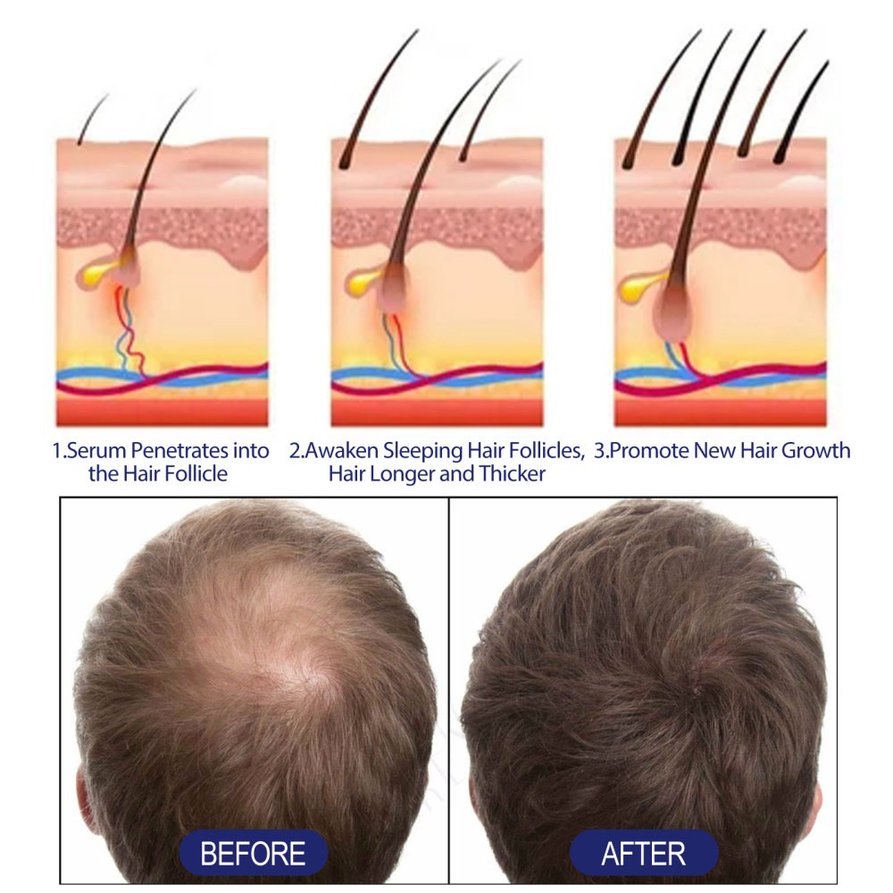 Men’s Hair Care Mousse Care Hair Root Hair Core Men’s Hair Plump