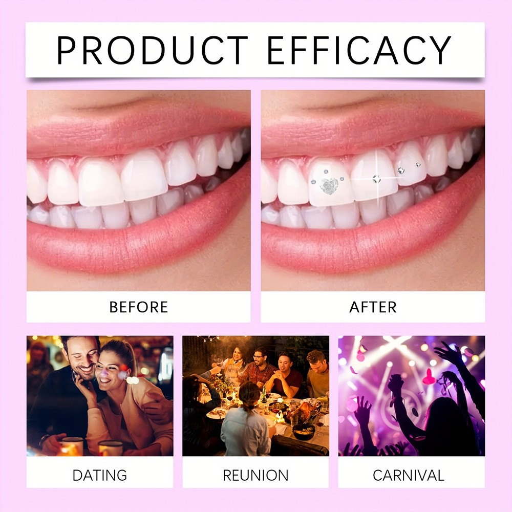 Complete Tooth Gem Kit with Adhesive and UV Light for Sparkling Teeth Decoration