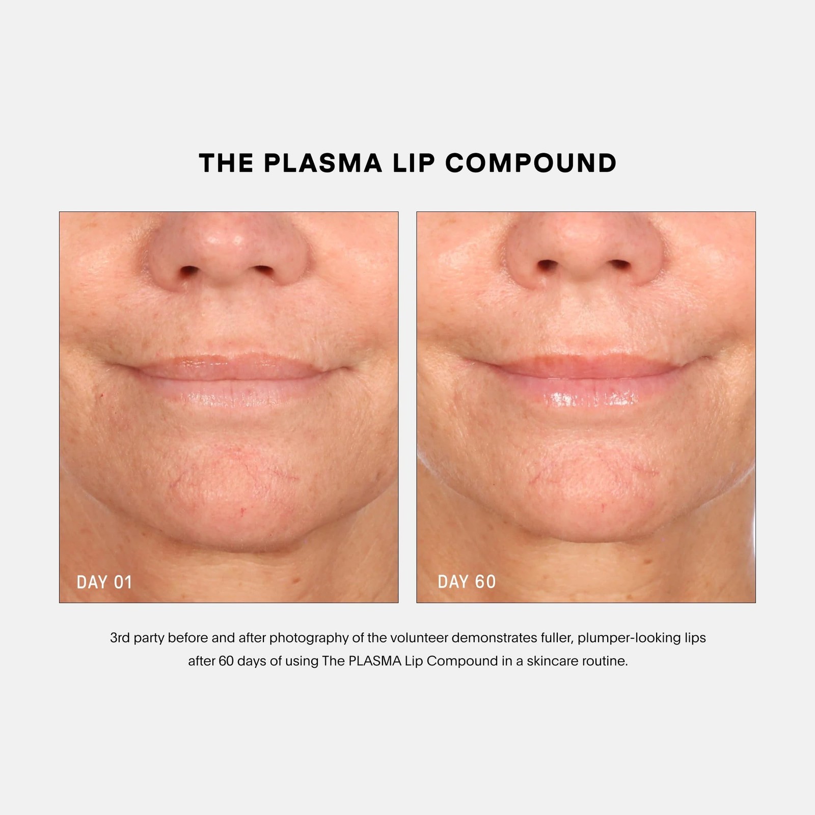 U Beauty 3-Piece Set – Resurfacing Compound 15mL + The SUPER Hydrator 15mL