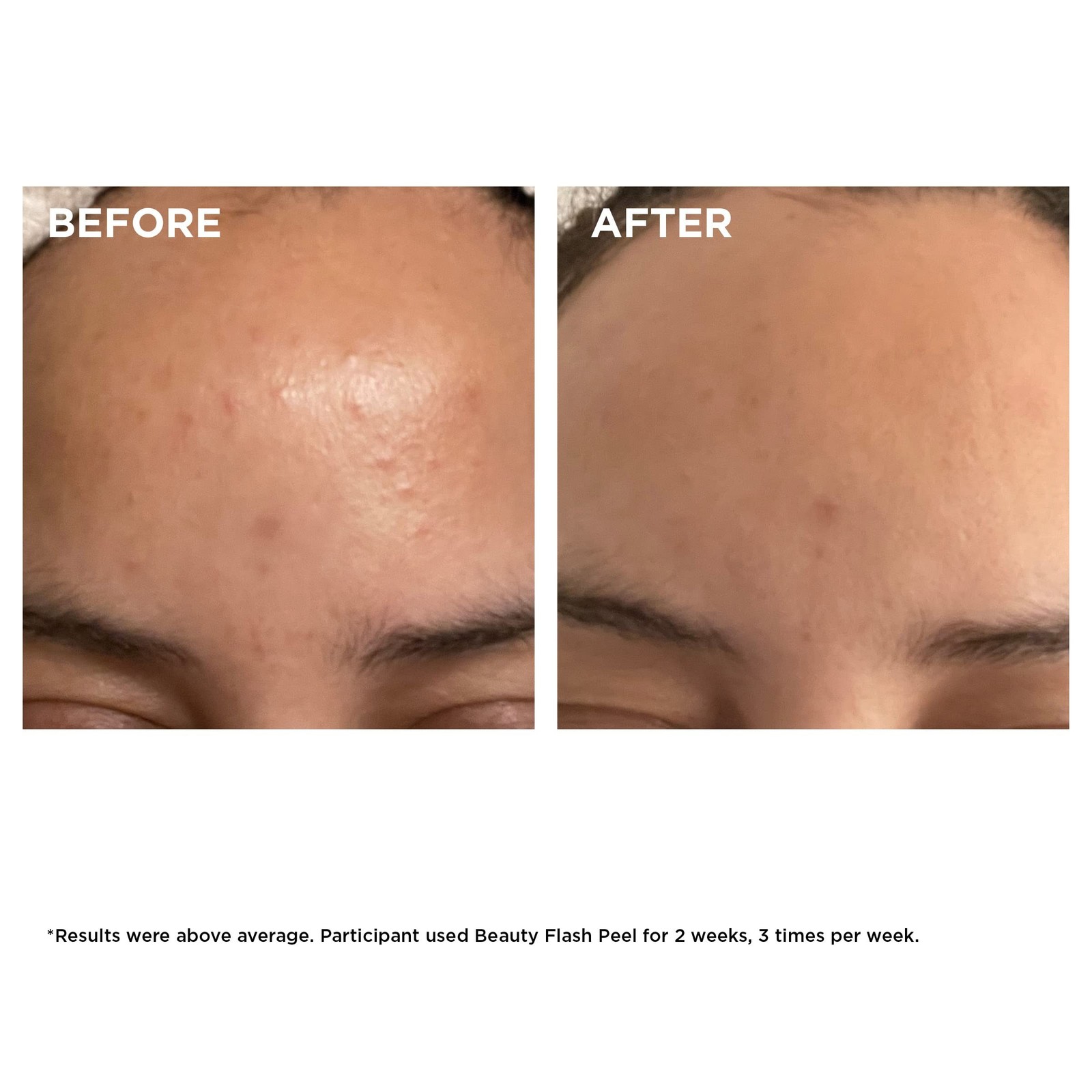 Clarins Beauty Flash Peel | 10-Minute At-Home Facial | Visibly Tightens Pores…