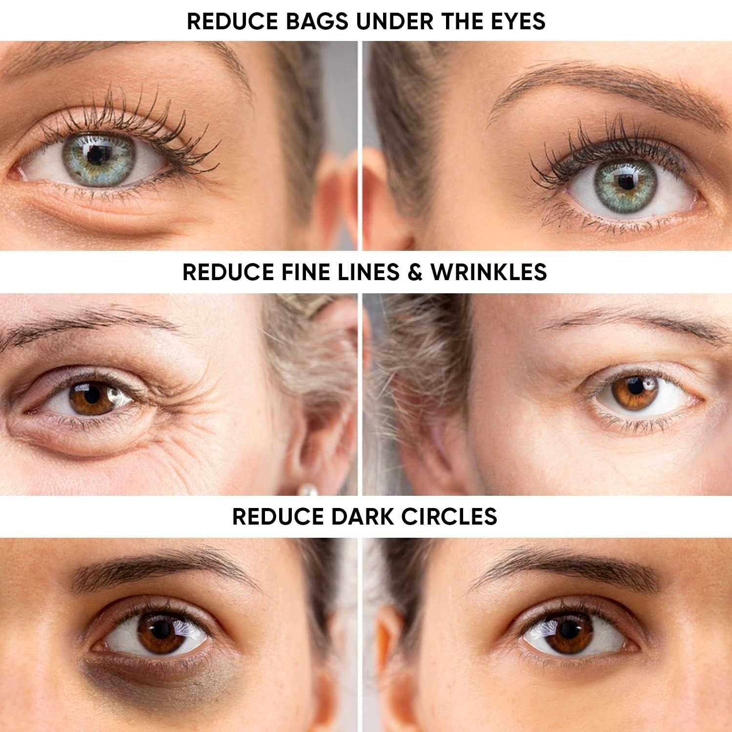 Instant Eye Tightener – Instantly Reduces Under Eye Bags, Puffiness, Dark