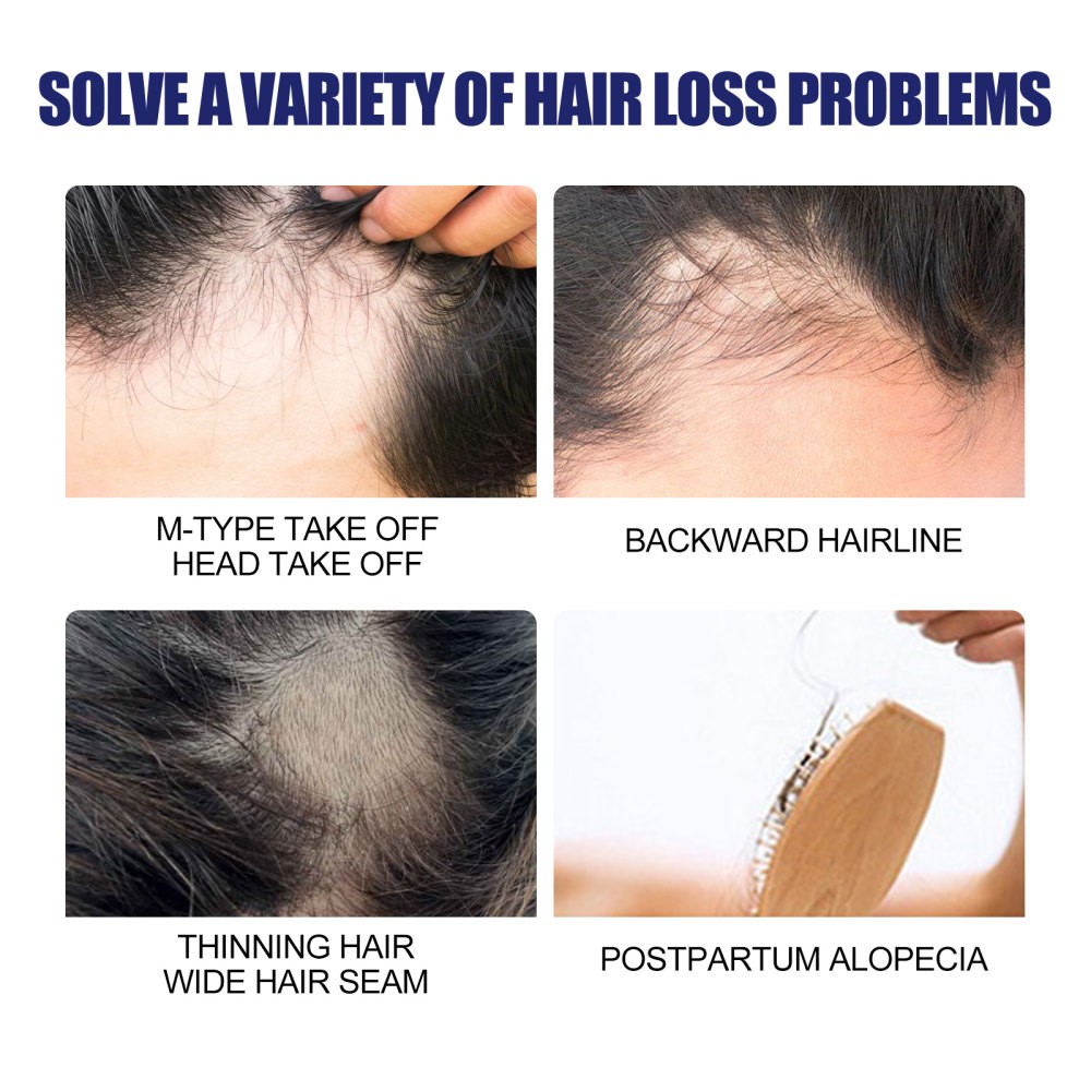 Men’s Hair Care Mousse Care Hair Root Hair Core Men’s Hair Plump