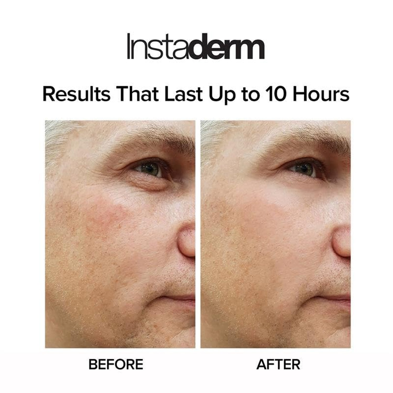Instant Eye Tightener – Instantly Reduces Under Eye Bags, Puffiness, Dark